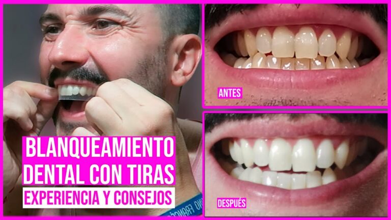 Techos deslizantes: maximizando la luz natural